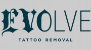 Evolve Tattoo Removal