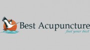 Best Acupuncture