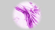Pain Resolution Institute