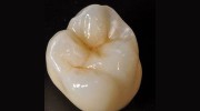 Golden Cusp Dental Labs