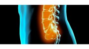 Scoliosis Care