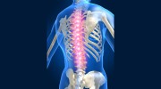 Houston Spine & Sports Medicine