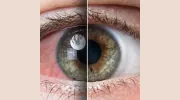 Pierz Eyecare