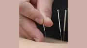 Innerchi Acupuncture