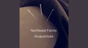 Northwest Family Acupuncture