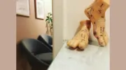 YZ Acupuncture