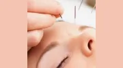 South Hill Acupuncture Clinic