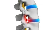Epic Pain Management