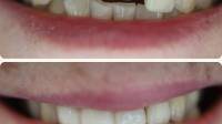 Cosmetic Dentistry