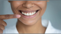 Teeth Cleaning