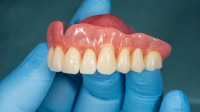 Dentures